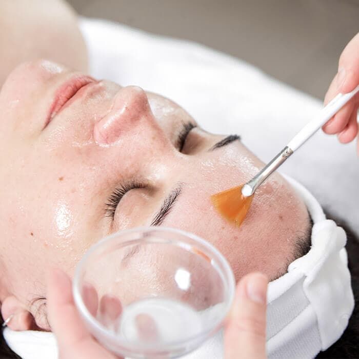 Chemical Peels 101: Benefits, Downtime, and Choosing the Right Peel for Your Skin