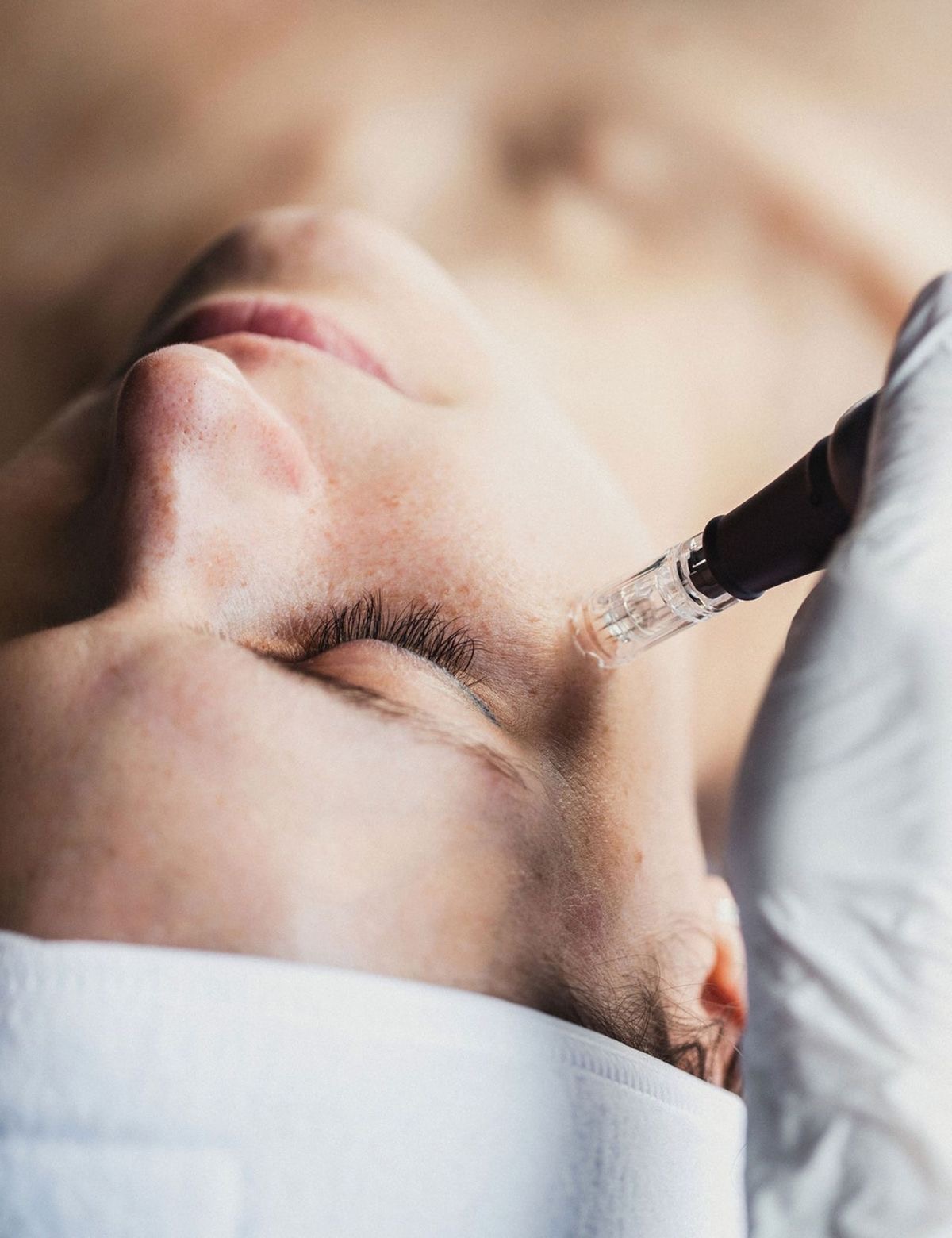 Microneedling with Exosome Solution: Next-Level Skin Regeneration